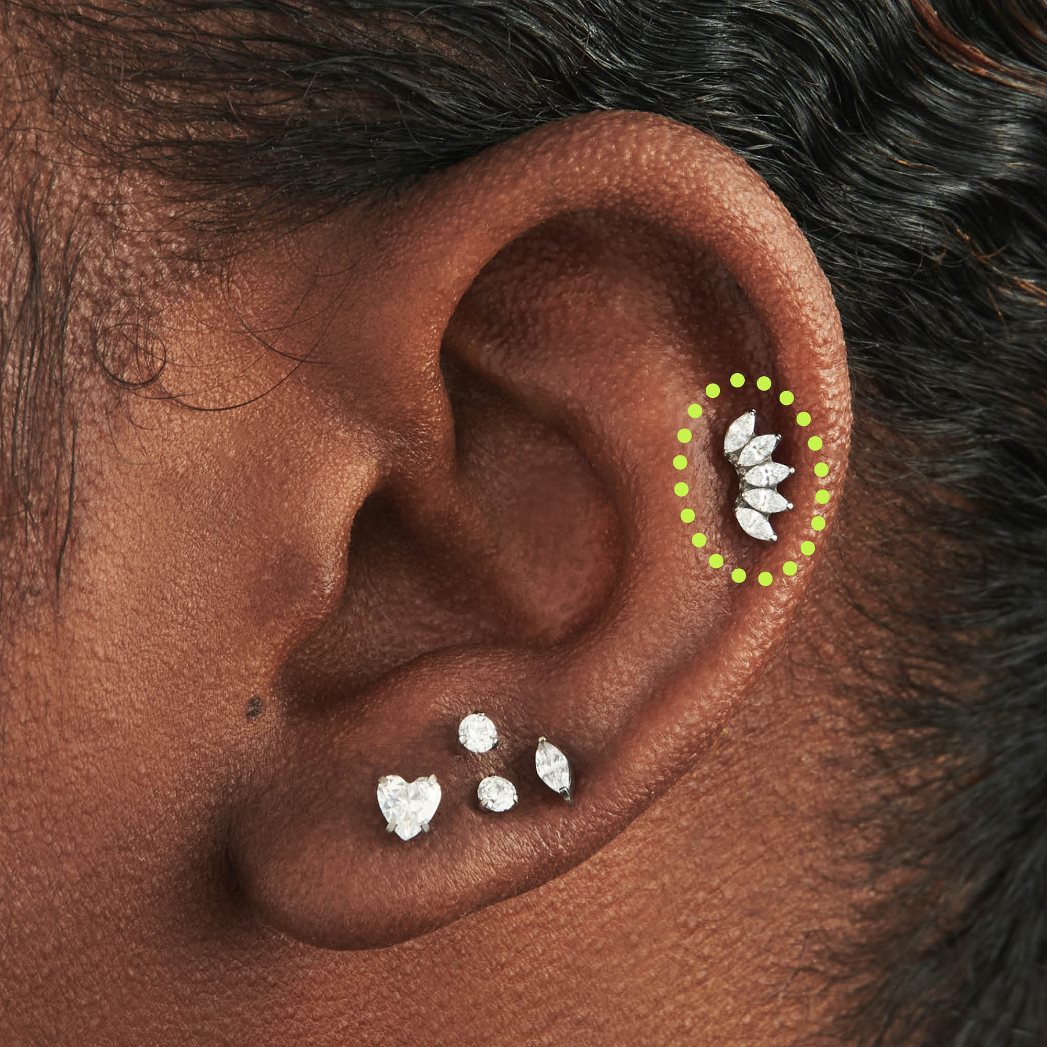 Alternative view of Titanium Crown